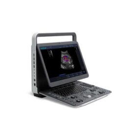 E2 color Doppler with Abdominal Probe