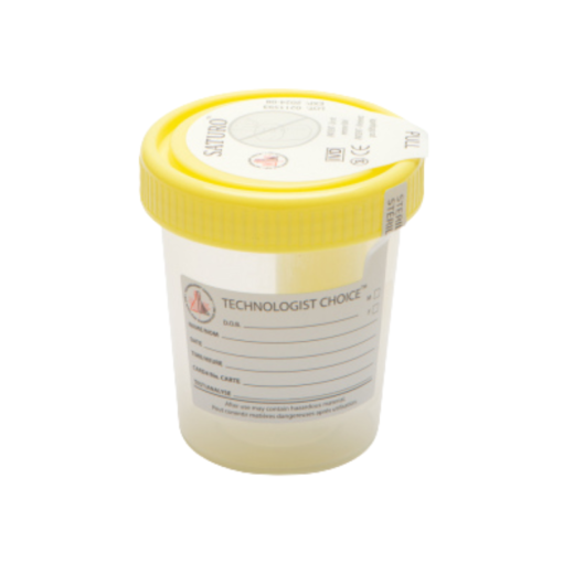 Mf Lab - Urine Container Yellow