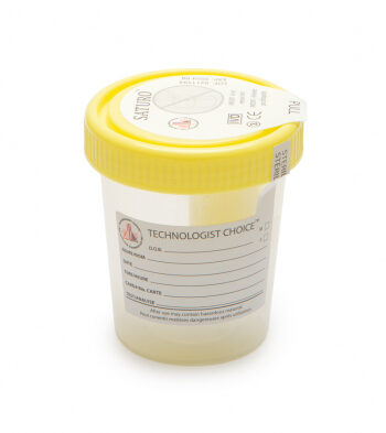 Mf Lab - Urine Container Yellow