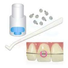 ortho-arch-bracket-bonder-tips-and-handle