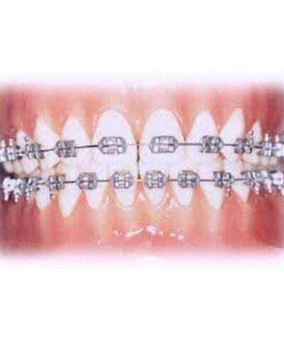 UR/LL Conlin Light Wire Composite Brackets Cuspid Bicuspid