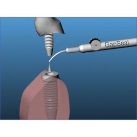 Hager & Werken - GapSeal