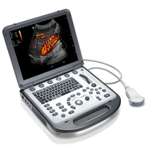 Mindray - Color Doppler Ultrasound Machine - IN-A680