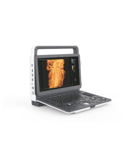 Zoncare M5 Portable Ultrasound Machine - Advanced Imaging, Lightweight Design